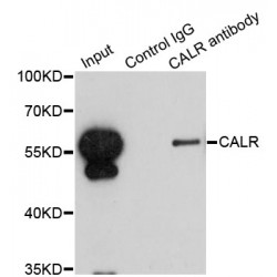 Calreticulin (CALR) Antibody