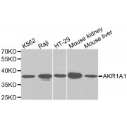 Western blot analysis of extracts of various cell lines, using AKR1A1 antibody (abx000991) at 1/1000 dilution.