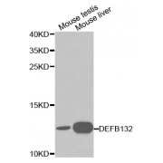 Western blot analysis of extracts of various cell lines, using DEFB132 antibody (abx000997) at 1/1000 dilution.