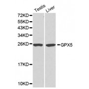 Western blot analysis of extracts of various cell lines, using GPX5 antibody (abx000998).