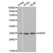 Western blot analysis of extracts of various cell lines, using HADH antibody (abx000999) at 1/1000 dilution.