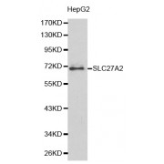 Western blot analysis of extracts of HepG2 cells, using SLC27A2 antibody (abx001000).