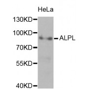 Western blot analysis of extracts of HeLa cells, using ALPL antibody (abx001003) at 1/1000 dilution.