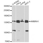Western blot analysis of extracts of various cell lines, using FLJ20294 Antibody (abx001006) at 1/1000 dilution.