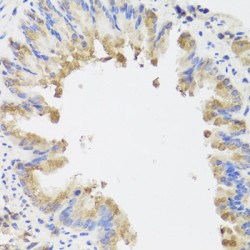 Activating Molecule In BECN1-Regulated Autophagy Protein 1 (AMBRA1) Antibody