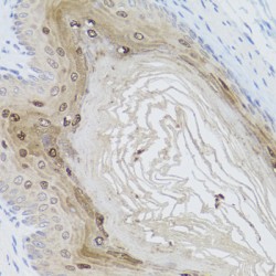 Activating Molecule In BECN1-Regulated Autophagy Protein 1 (AMBRA1) Antibody