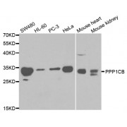 Western blot analysis of extracts of various cell lines, using PPP1CB antibody (abx001011) at 1/1000 dilution.