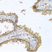Immunohistochemistry of paraffin-embedded human prostate using RNASE11 antibody (abx001012) at dilution of 1/100 (40x lens).