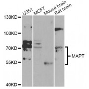 Western blot analysis of extracts of various cell lines, using MAPT Antibody (abx001022) at 1/1000 dilution.