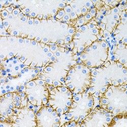 Microtubule-Associated Protein Tau (MAPT) Antibody