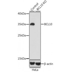 B-Cell Lymphoma/leukemia 10 (BCL10) Antibody