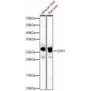 Western blot analysis of extracts of various cell lines, using GPX1 antibody (abx001027) at 1/1000 dilution.