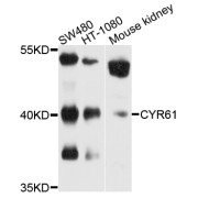 Western blot analysis of extracts of various cell lines, using CYR61 antibody (abx001028) at 1/1000 dilution.