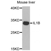 Western blot analysis of extracts of mouse liver, using IL1B antibody (abx001029) at 1/1000 dilution.