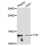 Western blot analysis of extracts of various cell lines, using TTR antibody (abx001035) at 1/1000 dilution.
