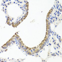 Transthyretin (TTR) Antibody