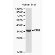 Western blot analysis of extracts of human brain, using CRH antibody (abx001037).
