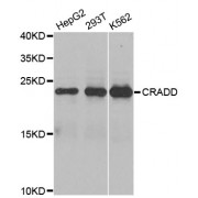 Western blot analysis of extracts of various cell lines, using CRADD antibody (abx001039) at 1/1000 dilution.