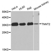 Western blot analysis of extracts of various cell lines, using TNNT2 antibody (abx001040) at 1/1000 dilution.