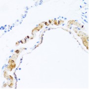 Immunohistochemistry of paraffin-embedded rat lung using PHPT1 antibody (abx001041) at dilution of 1/100 (40x lens).