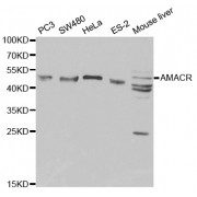 Western blot analysis of extracts of various cell lines, using AMACR antibody (abx001044) at 1/1000 dilution.