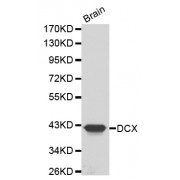 Western blot analysis of extracts of mouse brain, using DCX antibody (abx001048).