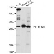 Western blot analysis of extracts of various cell lines, using TNFRSF10C antibody (abx001051) at 1:3000 dilution.