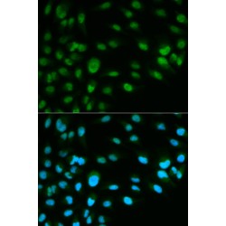 Minichromosome Maintenance Deficient 7 (MCM7) Antibody