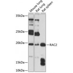 Ras-Related C3 Botulinum Toxin Substrate 2 (RAC2) Antibody