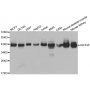 Western blot analysis of extracts of various cell lines, using ALDOA antibody (abx001056) at 1/1000 dilution.