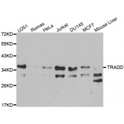 Western blot analysis of extracts of various cell lines, using TRADD antibody (abx001059) at 1/1000 dilution.