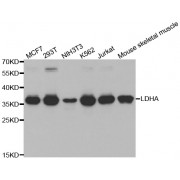 Western blot analysis of extracts of various cell lines, using LDHA antibody (abx001060) at 1/1000 dilution.