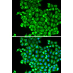 Lactate Dehydrogenase A (LDHA) Antibody