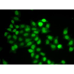 Mitotic Spindle Assembly Checkpoint Protein MAD1 (MAD1L1) Antibody