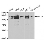 Western blot analysis of extracts of various cell lines, using KDM1A antibody (abx001070) at 1/1000 dilution.