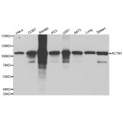 Western blot analysis of extracts of various cell lines, using ACTN1 antibody (abx001074) at 1/500 dilution.