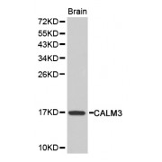 Western blot analysis of extracts of mouse brain, using CALM3 antibody (abx001075).