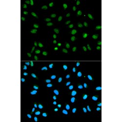 Heterogeneous Nuclear Ribonucleoprotein A2/B1 (HNRNPA2B1) Antibody