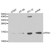 Western blot analysis of extracts of various cell lines, using PFN1 antibody (abx001078) at 1/1000 dilution.