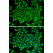 Immunofluorescence analysis of MCF-7 cells using RAB11A antibody (abx001081). Blue: DAPI for nuclear staining.