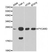 Western blot analysis of extracts of various cell lines, using PYCARD antibody (abx001084).
