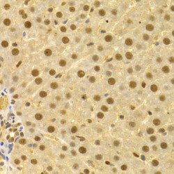 Cell Division Cycle 25A (CDC25A) Antibody