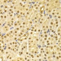 Cell Division Cycle 25A (CDC25A) Antibody