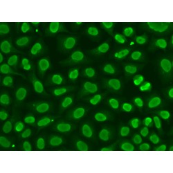 Flap Structure Specific Endonuclease 1 (FEN1) Antibody