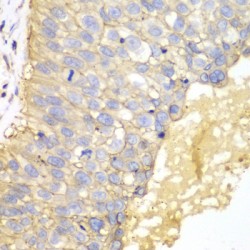 Tumor-Associated Calcium Signal Transducer 1 (TACSTD1) Antibody