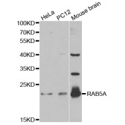 Western blot analysis of extracts of various cell lines, using RAB5A antibody (abx001094) at 1/1000 dilution.