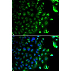 RAB5A, Member RAS Oncogene Family (RAB5A) Antibody