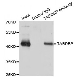 TAR DNA-Binding Protein 43 / TDP43 (TARDBP) Antibody