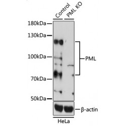 Promyelocytic Leukemia Protein (PML) Antibody