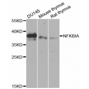 Western blot analysis of extracts of various cell lines, using NFKBIA antibody (abx001101) at 1/1000 dilution.